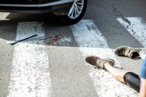 ​Can You Sue Someone for Running You Over